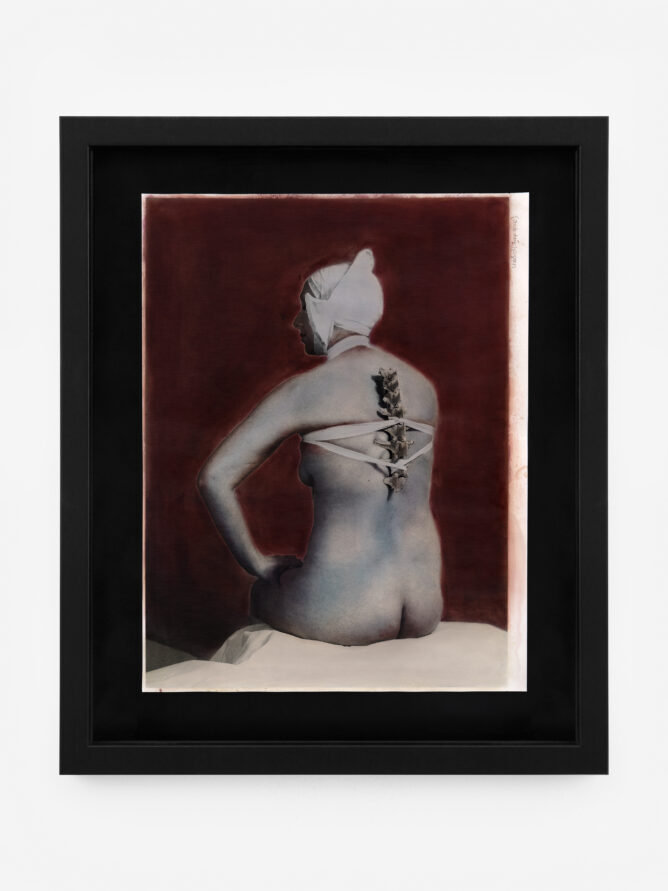 Untitled (Sheep Spine), 2024. On Being Forced To Take My Medicine. Hand-coloured silver gelatine print, and 10″ x 8″, edition I.